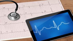 Electrocardiogram and stethoscope