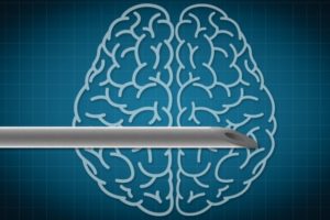 smaller brain implants MIT
