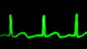 heartbeat 