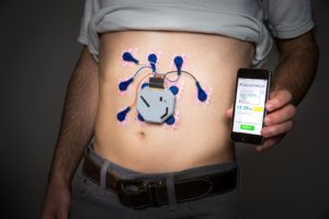 UCSD stomach monitor wearable