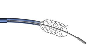 neurovascular stent delivery system Integer Holdings neurovascular devices 