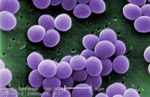 Staphylococcus aureus CDC Centers for Disease Control and Prevention superbugs 