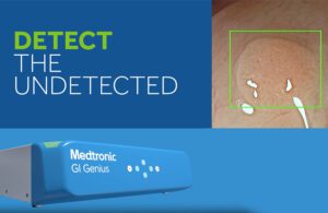 This Medtronic GI Genius marketing image shows the module box as well as a green box around suspected polyp during a colonoscopy.