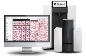 The Scopio full-field digital cell morphology scanner and a screen displaying blood cells.