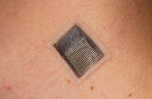 A small, thin sticker-like wearable ultrasound device.