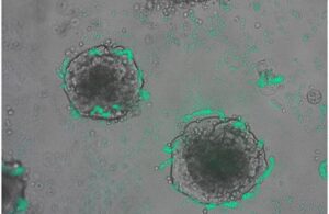 Bacteria Abaylyi Tumor UC San Diego DNA detect tumor cells