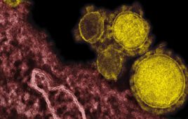 An electron microscope image shows the MERS virus colorized in yellow.