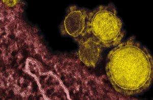 An electron microscope image shows the MERS virus colorized in yellow.