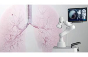 A Noah Medical illustration combining a photo of its Galaxy robotic bronchoscopy system with an image of the scope in the lungs.